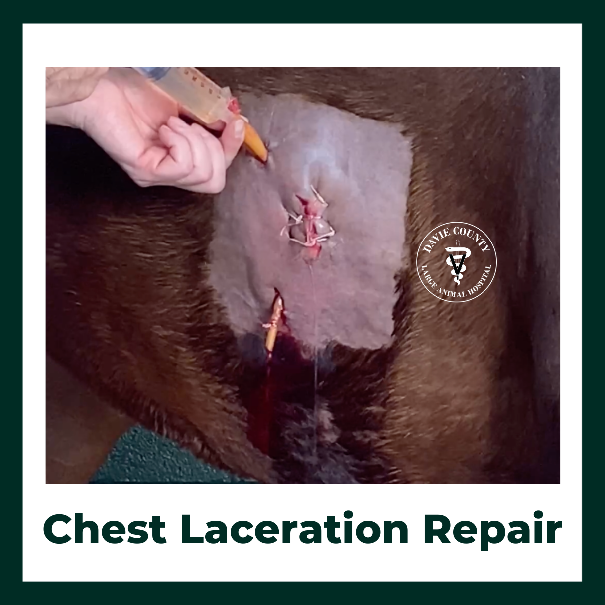 Chest Laceration Repair